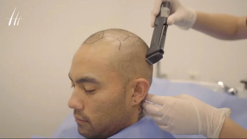 Dr Serkan Aygın Hair Transplant Clinic - Istanbul Turkey – Sahibinin seçtikleri · Okmeydani, İstanbul