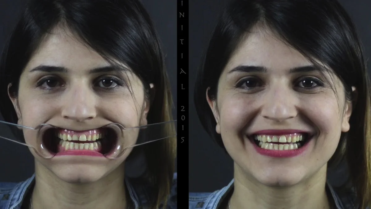 DentAtlas Ağız Ve Diş Sağlığı Polikliniği – Videolar · Çarşi, Kocaeli