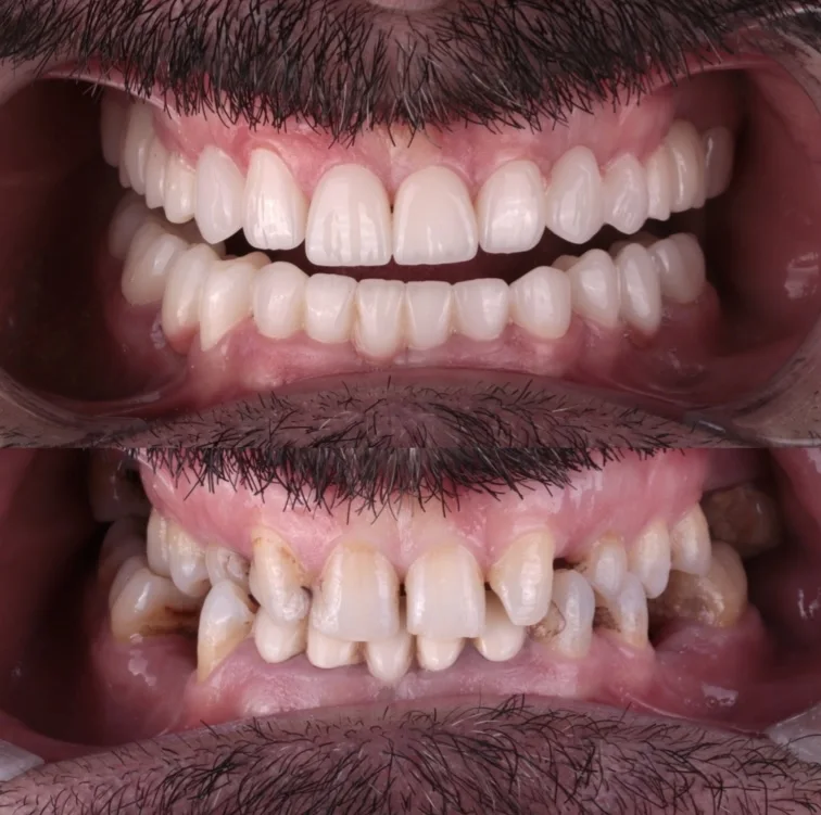 DentAtlas Ağız Ve Diş Sağlığı Polikliniği – Sahibinin seçtikleri · Çarşi, Kocaeli