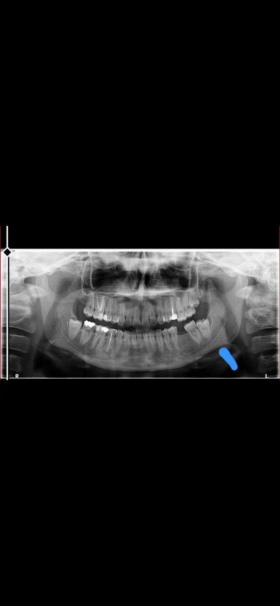 Ağız Diş ve Çene Cerrahisi Uzmanı Dr.Dt.Seda Deniz Kalkan implant zirkonyum diş – Ziyaretçi fotoğrafı: Tuba Kırbıyık · 100.Yil, Ankara